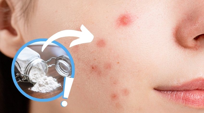 Secret Medicinal Uses For Baking Soda (you might be surprised by)